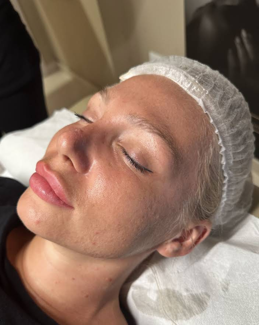 GDM Beauty Lab — risultato trattamento